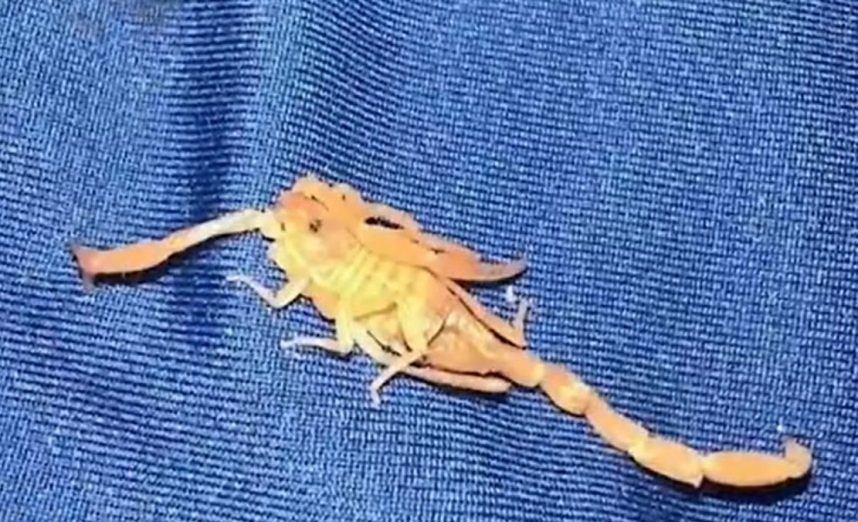 Man Stung in Nads by Scorpion While Sleeping at Las Vegas Resort